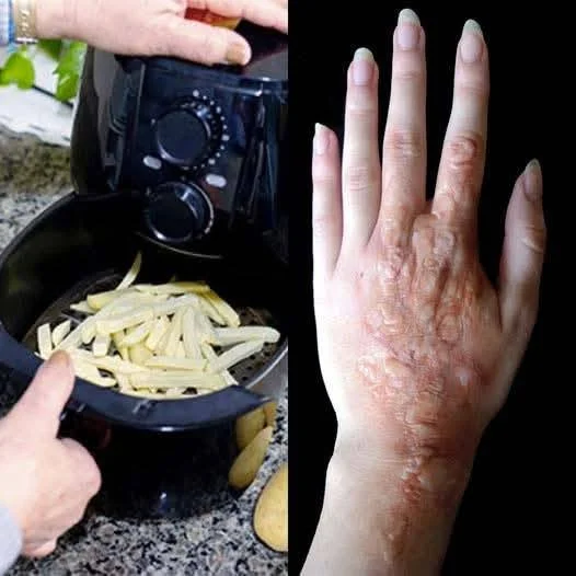 Airfryer jako potenciální nebezpečí pro zdraví a bezpečnost