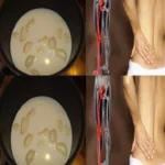 Česnekové mléko jako přírodní lék na ischias