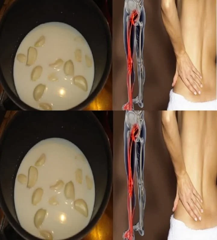 Česnekové mléko jako přírodní lék na ischias