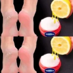 Vaselina citron pro krásnou a zdravou pleť