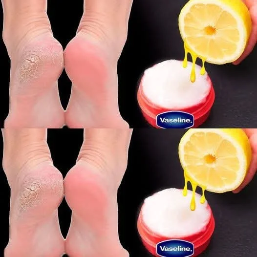 Vaselina citron pro krásnou a zdravou pleť