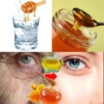 Přírodní zázrak medu a vody pro mladistvý vzhled bez Botoxu